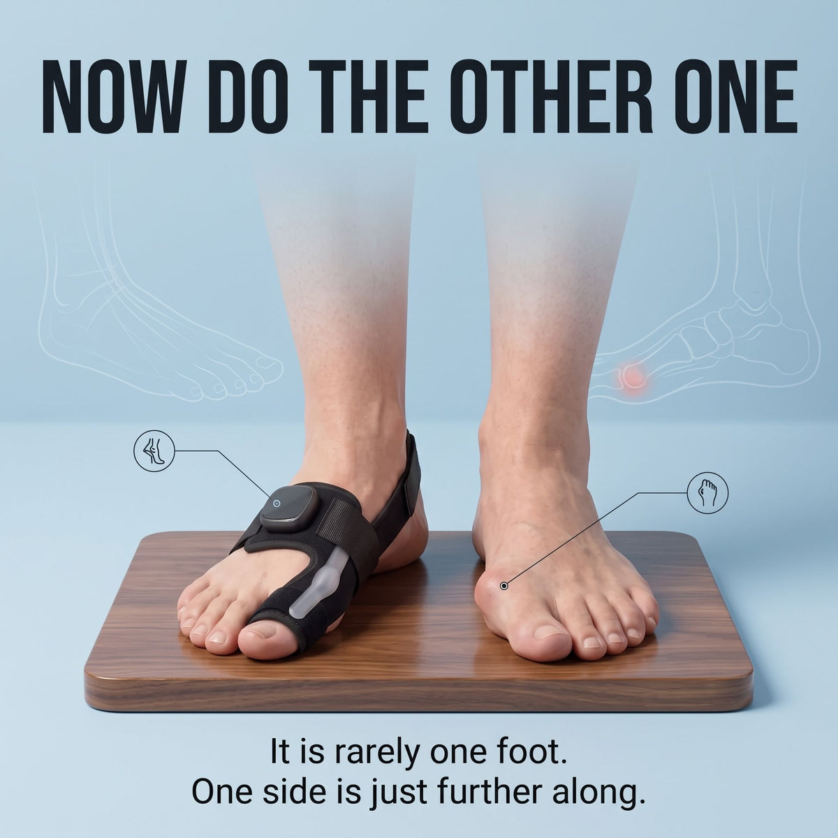Goluxera EMS Pro Bunion Corrector