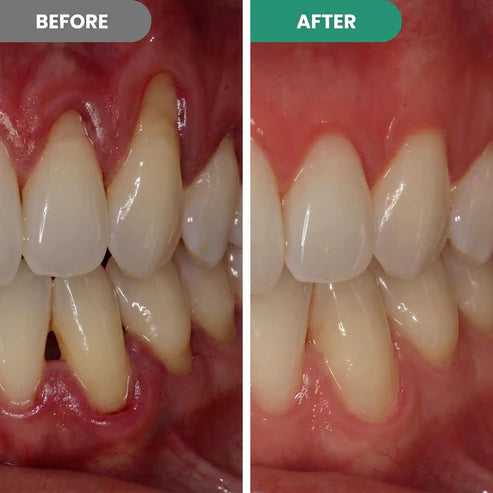 Maximum Strength Teeth Repair Pen