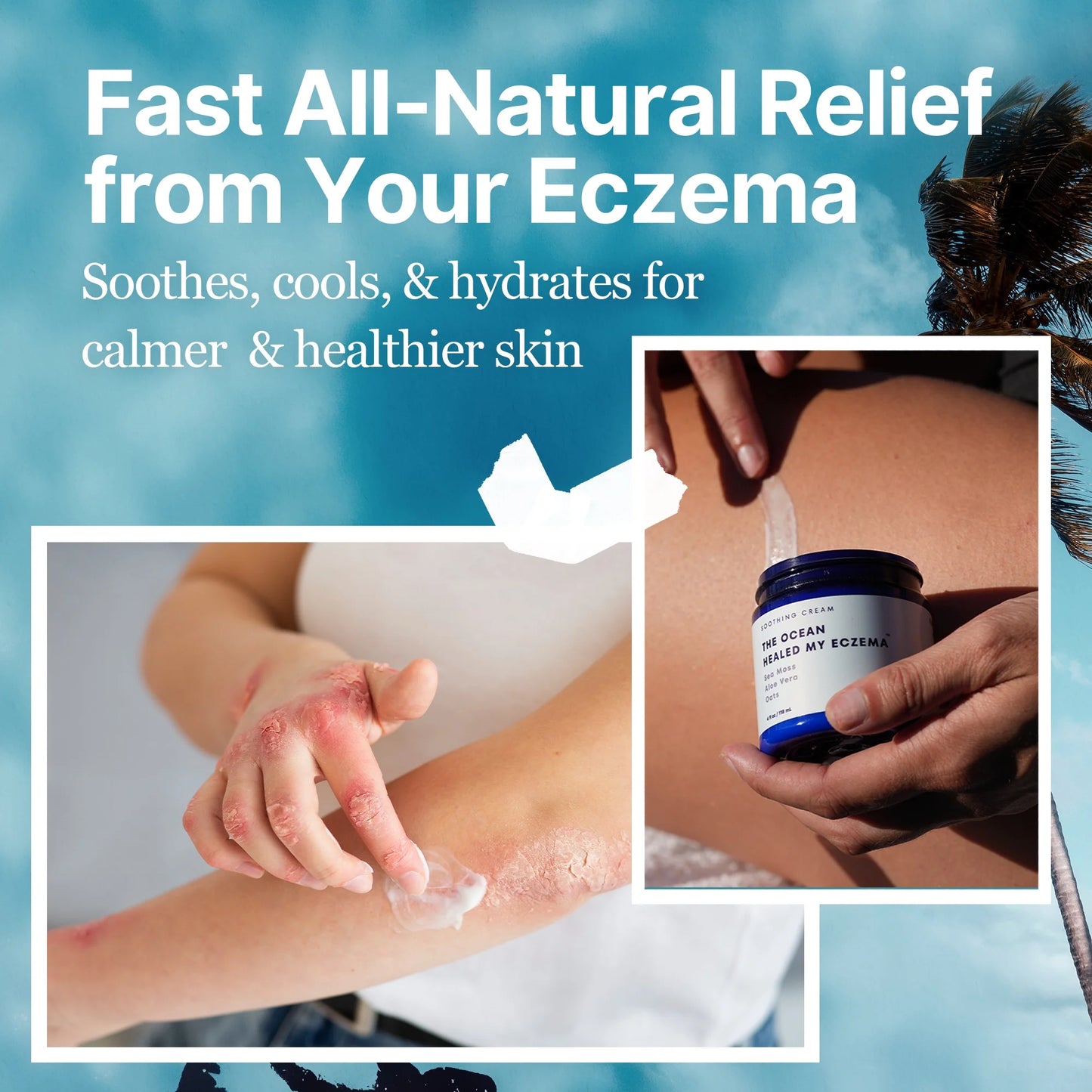 Ocean Relief™ Intensive Sea Moss Soothing Cream