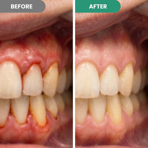 Maximum Strength Teeth Repair Pen