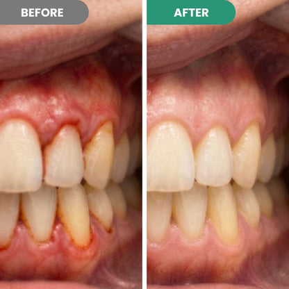 Maximum Strength Teeth Repair Pen