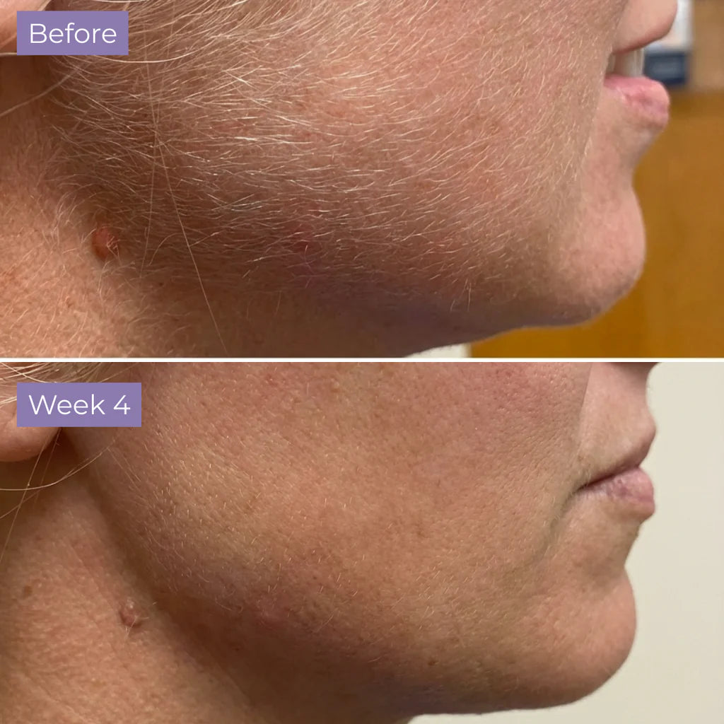 Cyperus Rotundus Serum