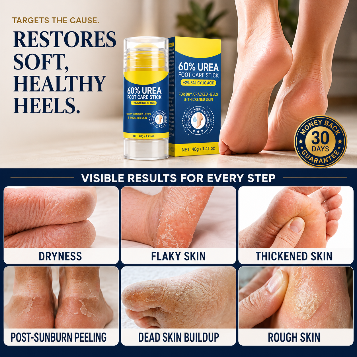 Maximum Strength 60% Urea Foot Repair Stick