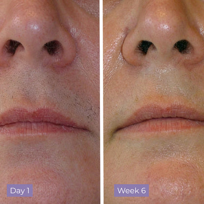 Cyperus Rotundus Serum