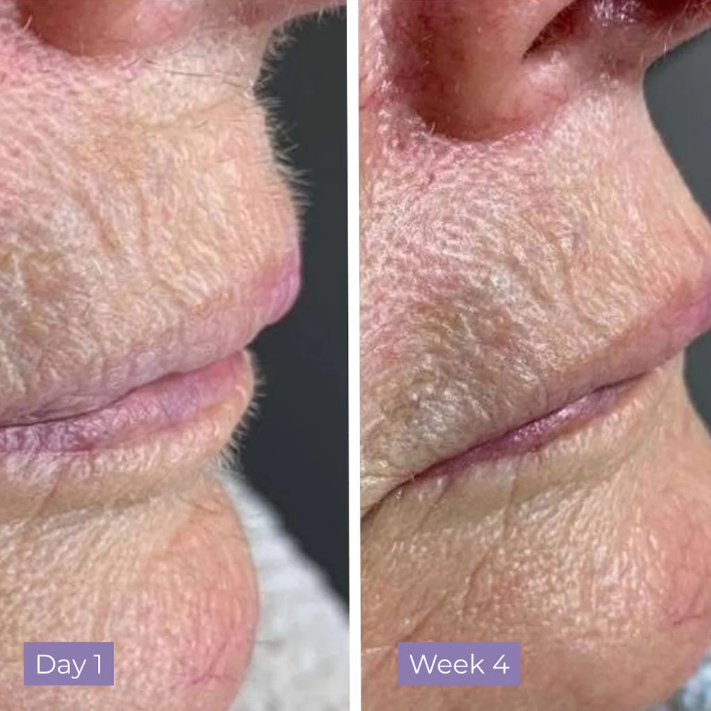 Cyperus Rotundus Serum