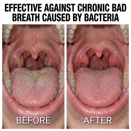 Tonsil Care Spray - Target The Hidden Bacteria